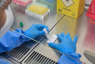 Anvisa atualiza regras para controle de qualidade em laboratórios; prazo de 1 ano para adequação