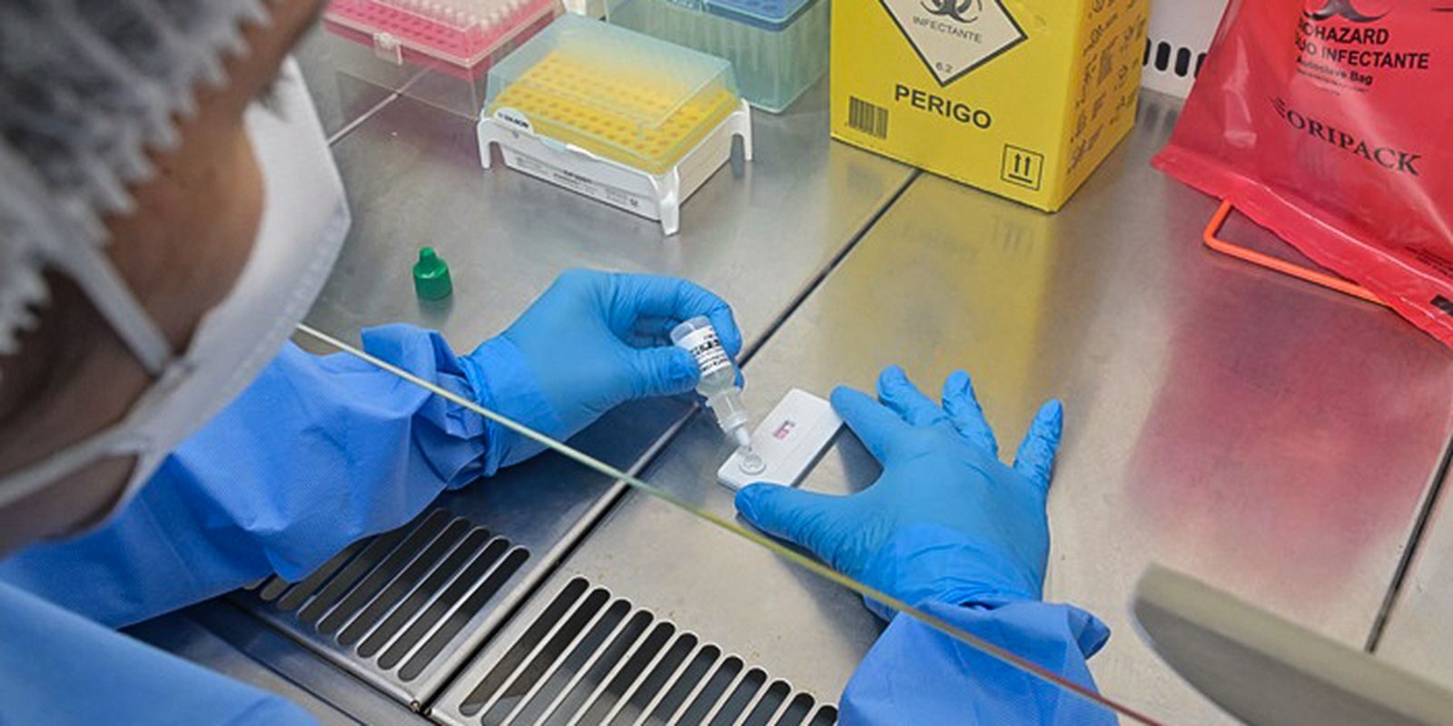 Anvisa atualiza regras para controle de qualidade em laboratórios; prazo de 1 ano para adequação