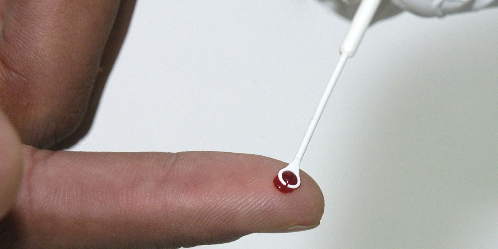 Fiji decreta emergência nacional por aumento abrupto de casos de HIV; 1 em cada 60 pessoas vive com o vírus